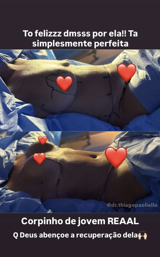 antes e depois Margareth Serrão e Virginia - Reprodução Instagram @virginia